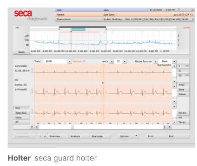 Seca Holter License