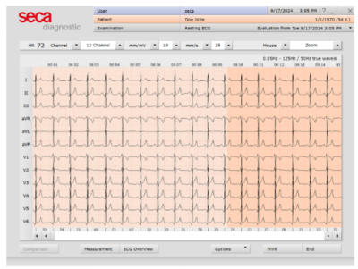 Seca Diagnostic Software Upgrade & ECG Licence (From Cardio 150. Windows 11 Compatible)