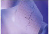 Welch Allyn ECG Paper for CP100 / CP150 / CP200 (Z-fold)