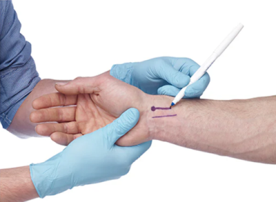 Sterile Surgical Skin Marker - Regular Tip
