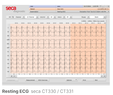 Seca ECG License