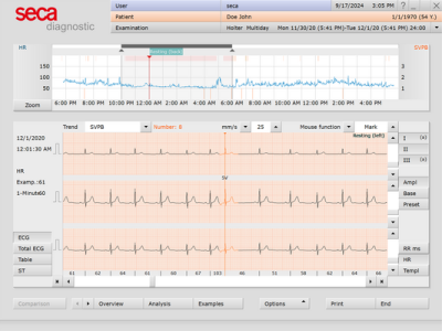 Seca Holter Analysis ECG Software (7 Days)
